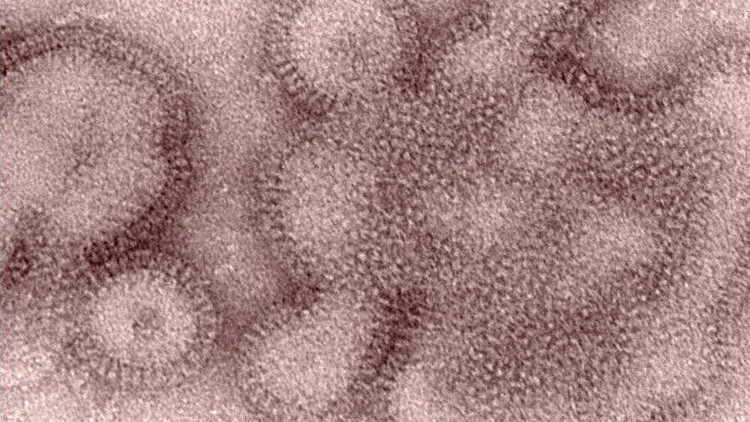ABD’de H3N2 virüsü endişesi: Farklı ülkelerde de görüldü! Salgın şiddetli olabilir