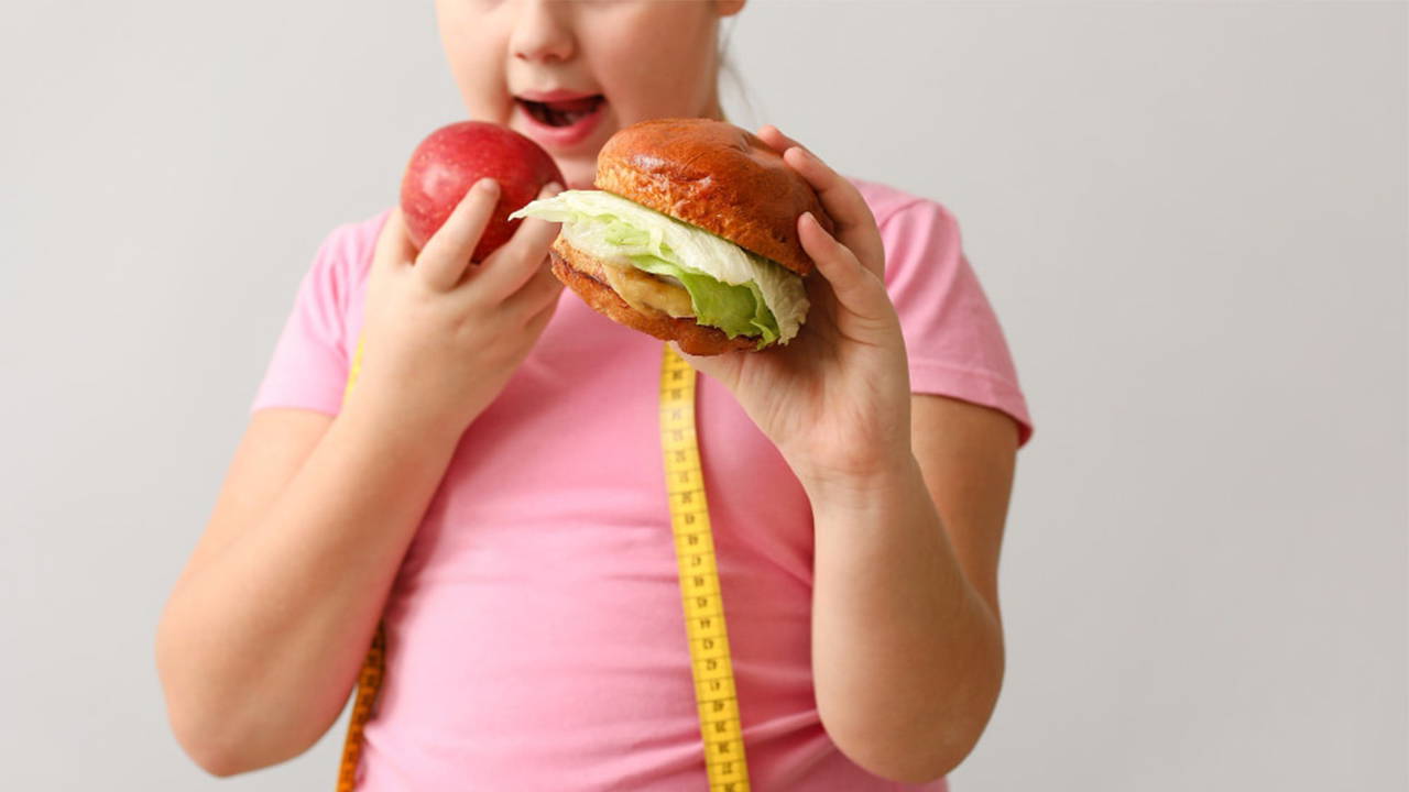 ‘Anne ve baba obezse çocukta risk yüzde 90’a kadar çıkıyor’