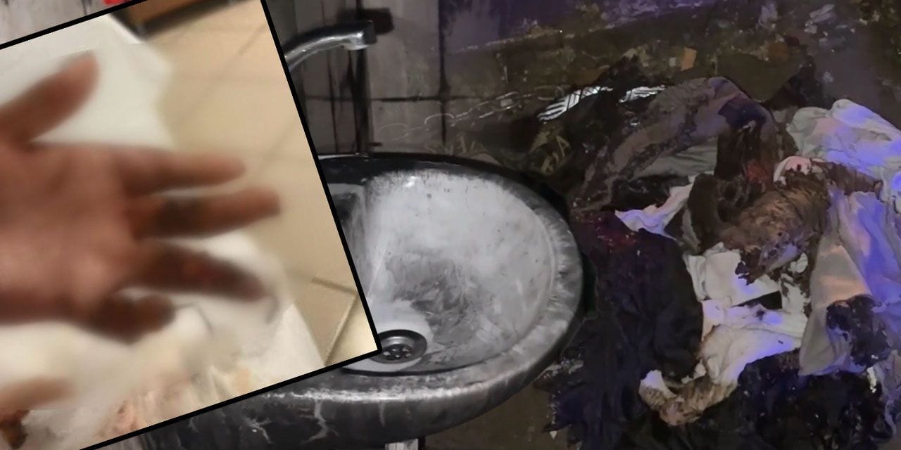 Kuaförde kabusu yaşadı, 14 yaşındaki Engin’in tüm vücudu yandı: O anları anlattı